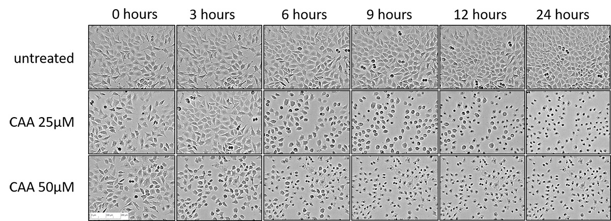 Cell Owl Effects on Cell Morphology